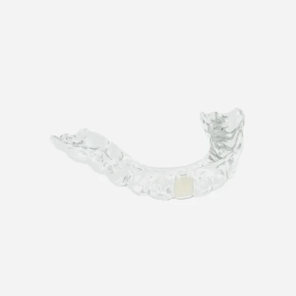 Retainer denture   (Extra impression putty)